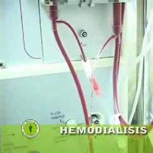 Servicio de Hemodiálisis