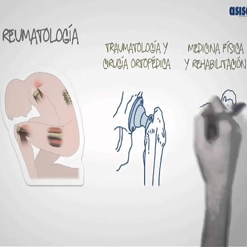 Servicio de Reumatología