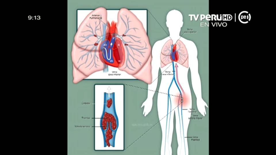 Diapositiva4